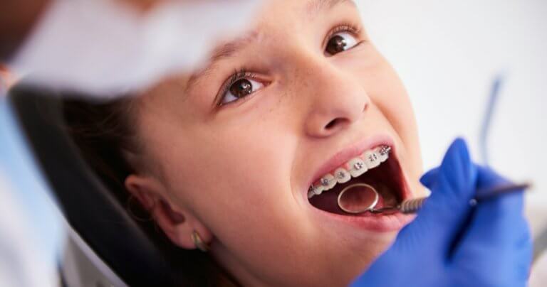 Thoughts about orthodontics - girl with braces during dental examination - Gillespie Approach–Craniosacral Fascial Therapy
