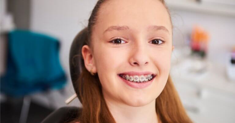 Orthodontic dilemma - smiling child with braces - Gillespie Approach–Craniosacral Fascial Therapy