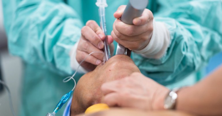 Intubation - Gillespie Approach–Craniosacral Fascial Therapy