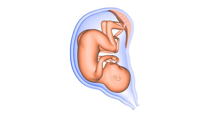 Bicornuate uterus infant - illustration - Gillespie Approach–Craniosacral Fascial Therapy
