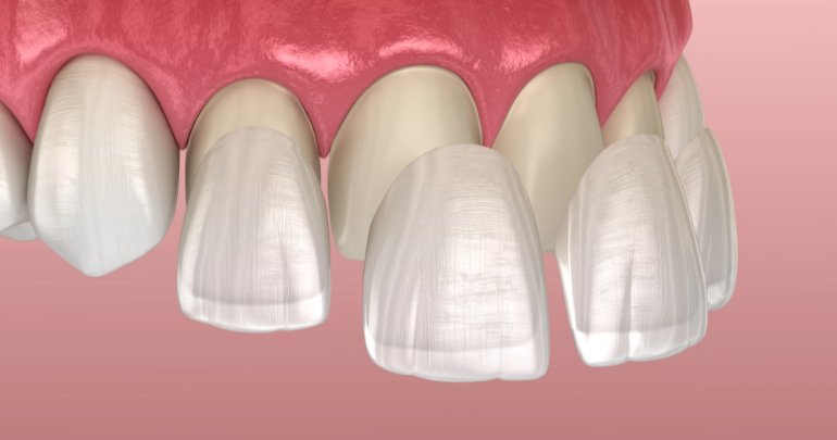 Gingival pain - gums-teeth illustration - Gillespie Approach–Craniosacral Fascial Therapy